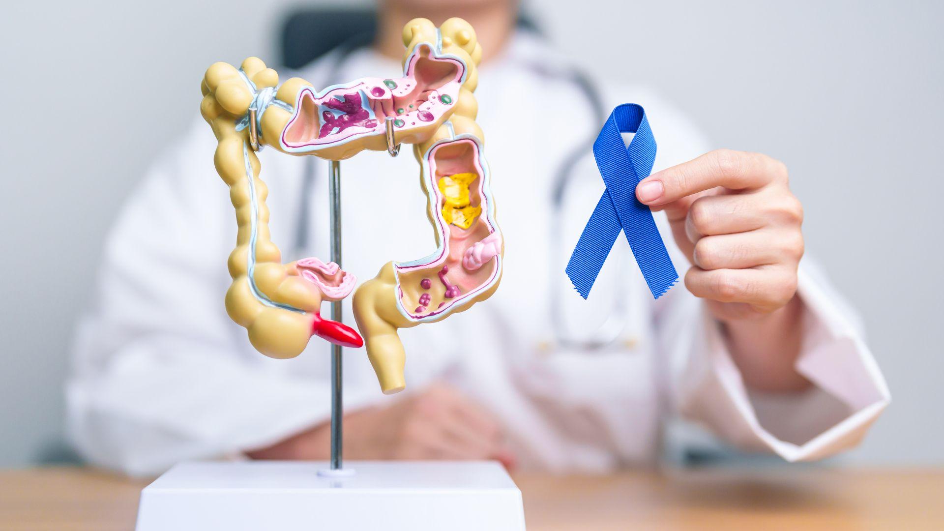 Are You at Risk? Recognising the Silent Symptoms of Colorectal Cancer 